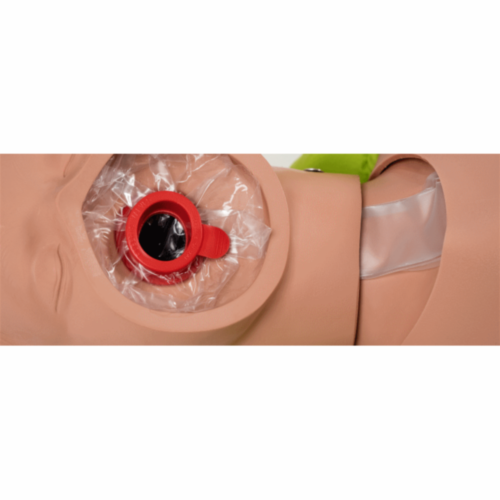 Ambu Junior Abdichtungsringe (10) - 8041
